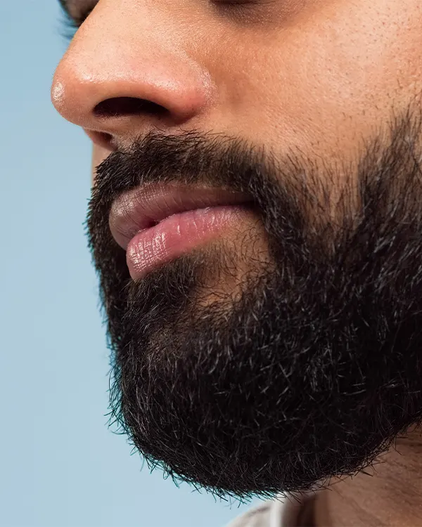 Img-beard-hair-transplant-in-bogota